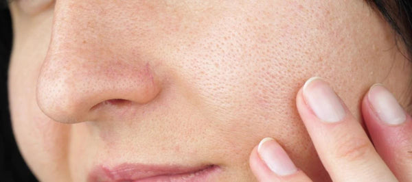 how to minimise pores