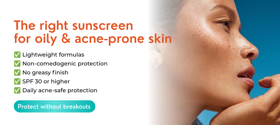How to Choose the Right Sunscreen for Oily and Acne-Prone Skin