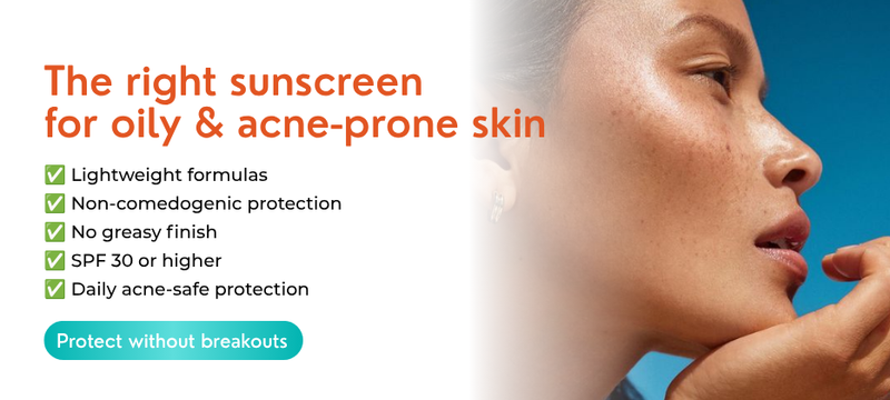 How to Choose the Right Sunscreen for Oily and Acne-Prone Skin