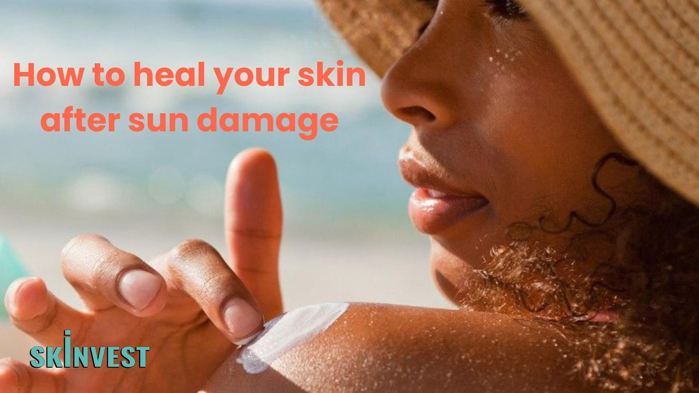 how to heal sun damage