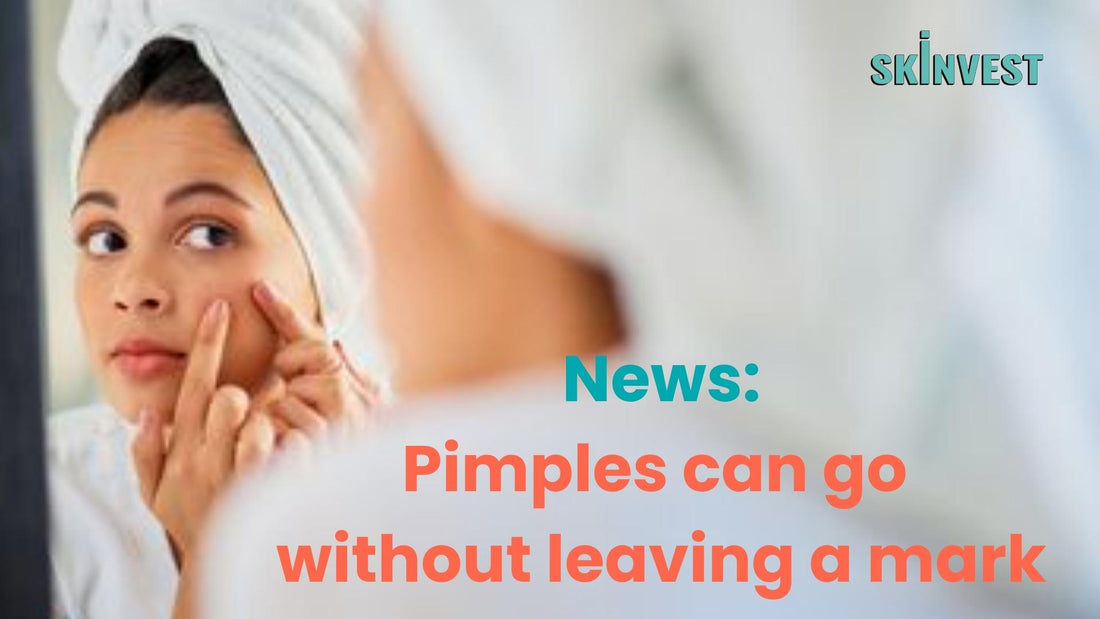 Acne Scars what is treatment