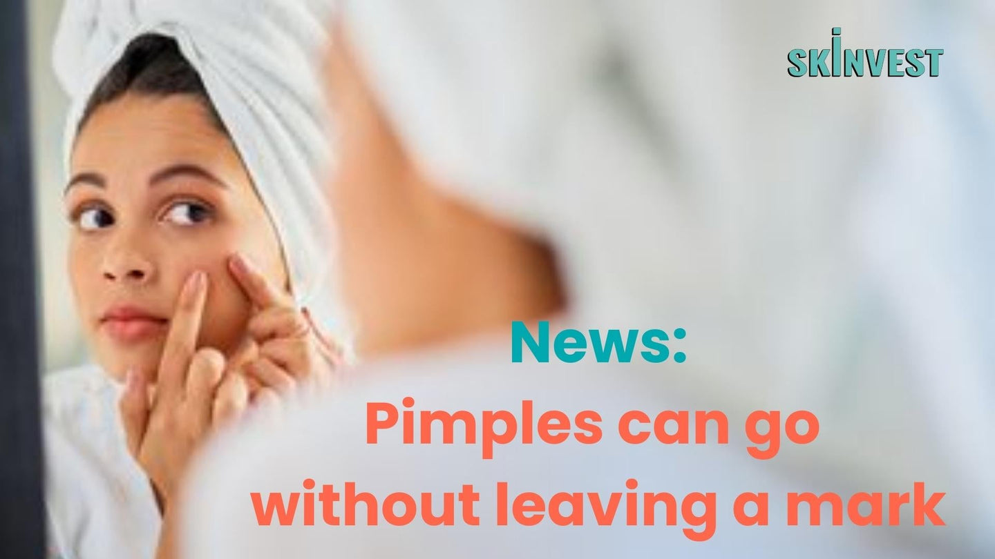 Acne Scars what is treatment