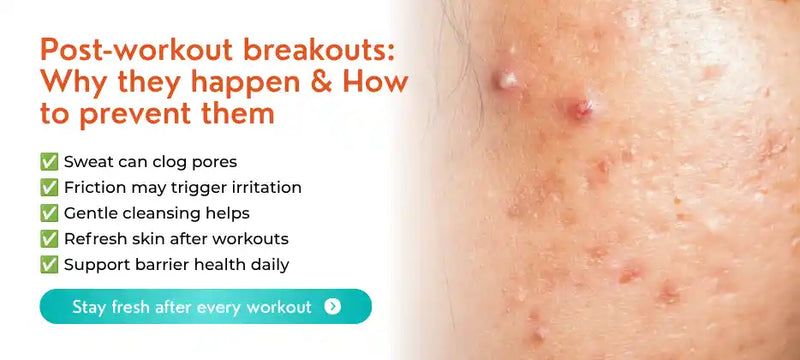 Post-Workout Acne, Sweat, and Skin Irritation: How to Prevent It