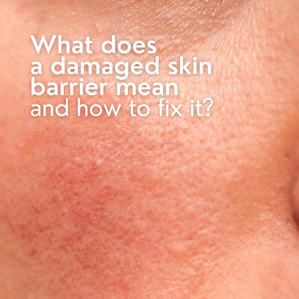 What Does a Damaged Skin Barrier Mean and How to Fix It