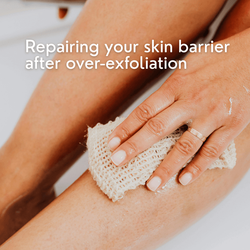 How to Repair Your Skin Barrier After Over-Exfoliation