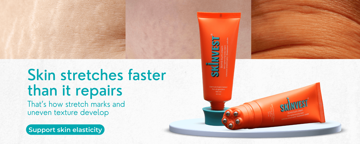 Stretch marks & Cellulite