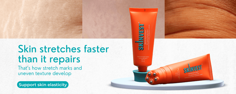 Stretch marks & Cellulite