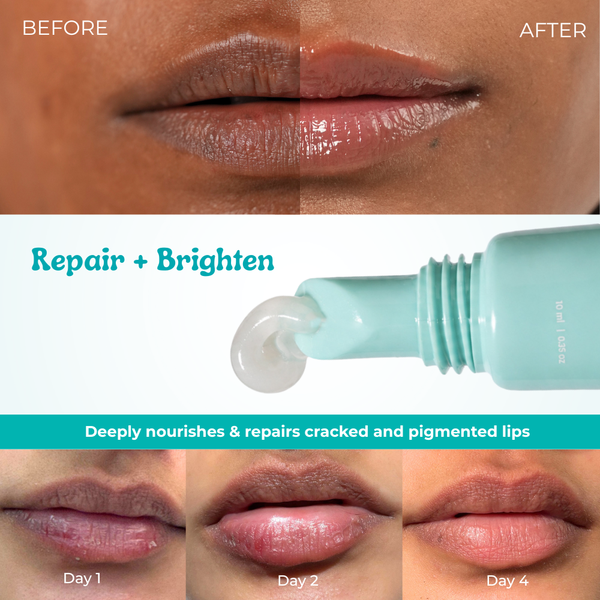 Melts Ultimate Lip balm