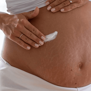 Skin tightening body cream for cellulite and stretch marks reduction