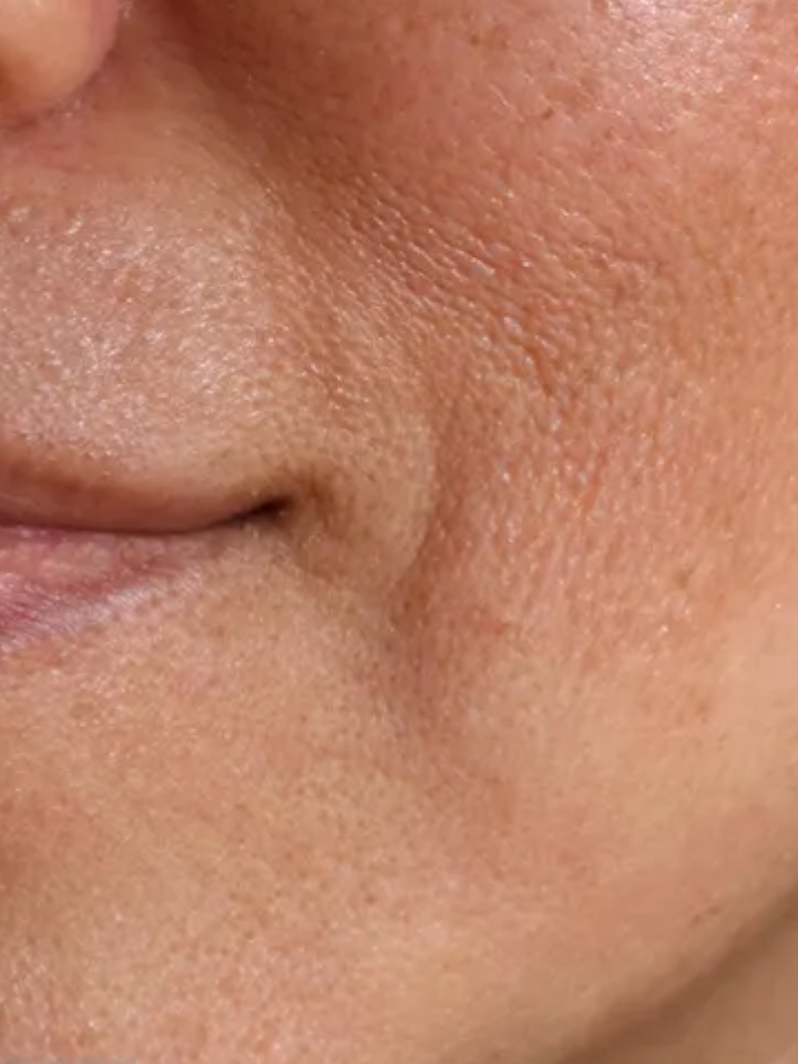 Close-up of a person's skin with a focus on texture and color.