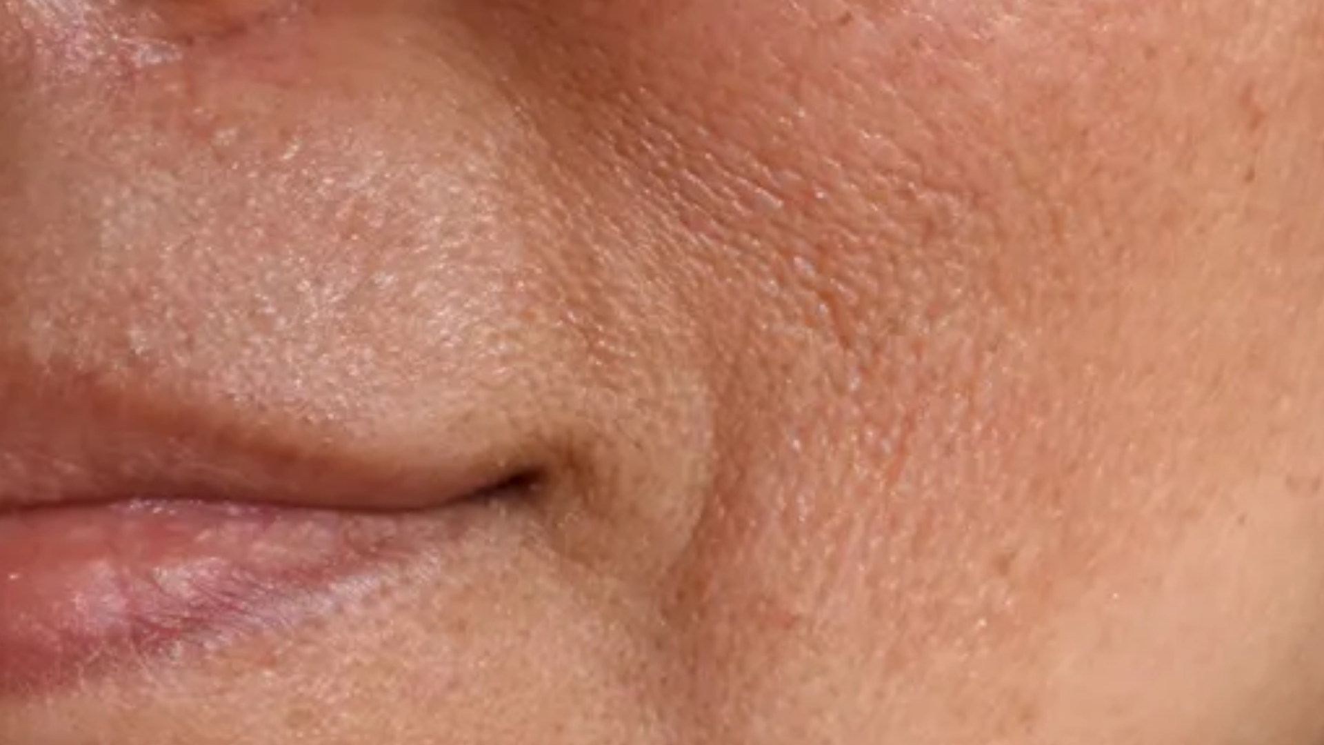 Close-up of a person's nose and lips with visible skin texture.
