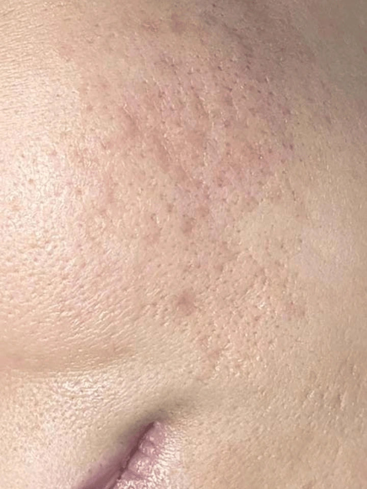 Close-up of skin with visible pores and texture