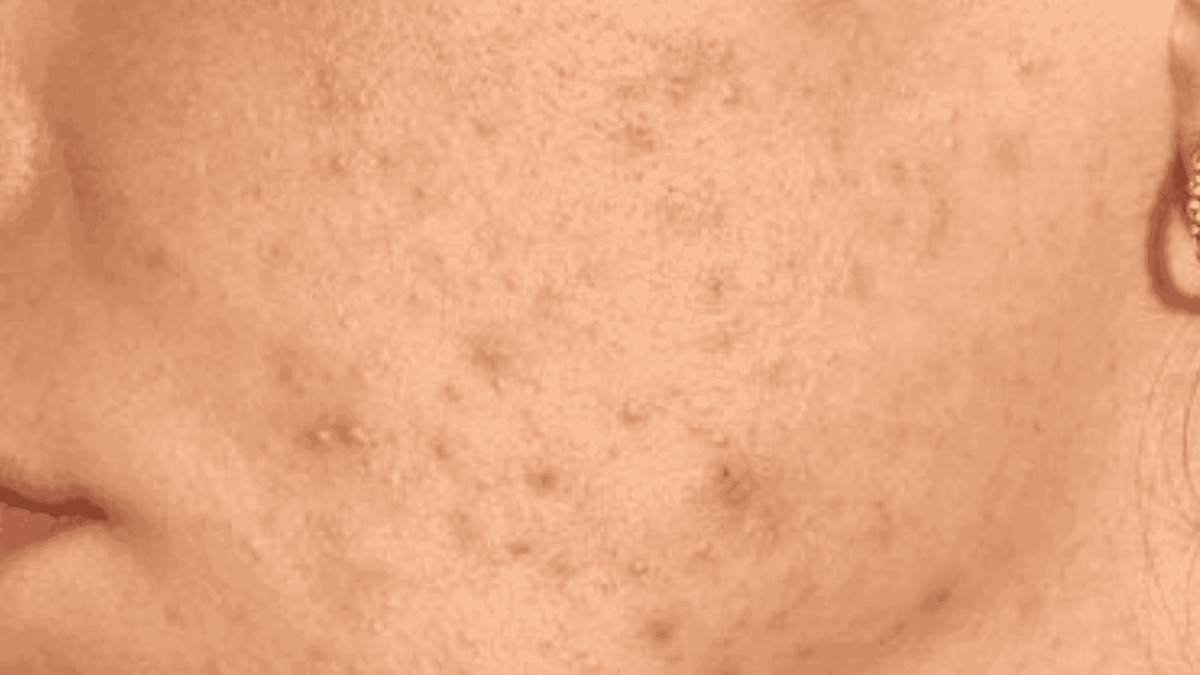Close-up of a person's neck with visible skin texture and pores.
