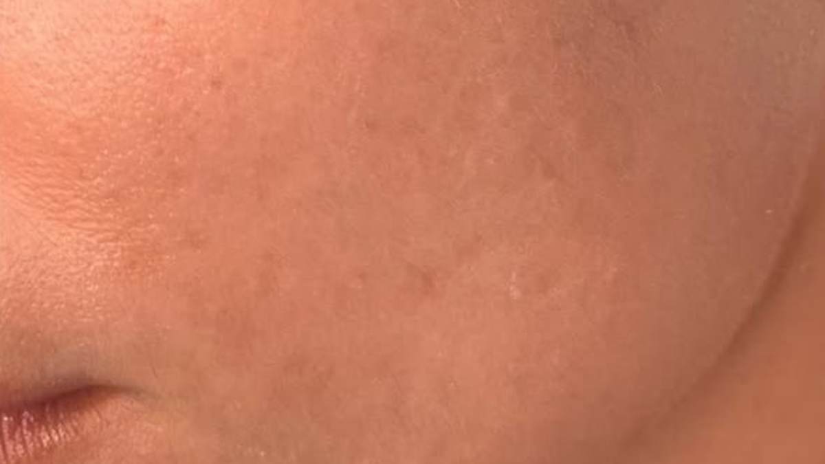 Close-up of a person's neck with visible skin texture
