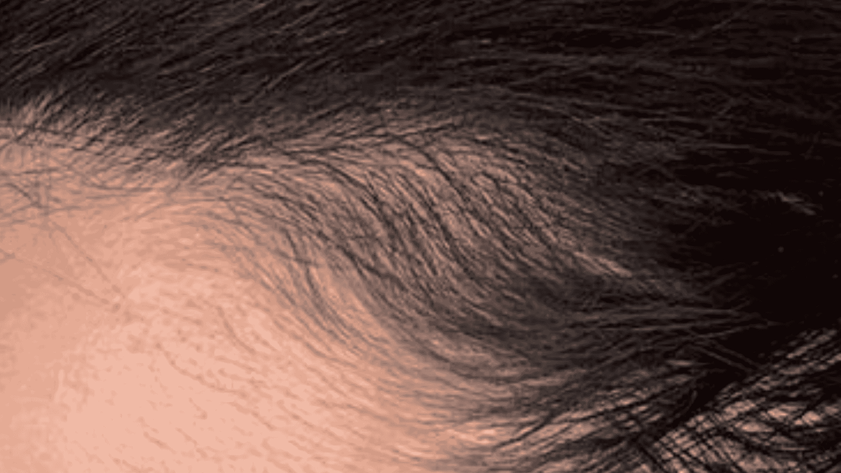 Close-up of hairline and scalp with dark hair and light skin