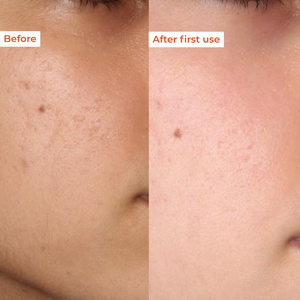 Resurface  Anti-tan peeling gel