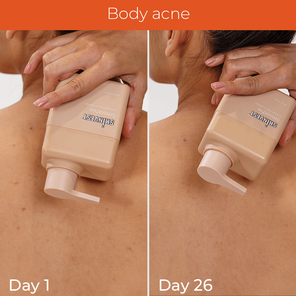 Skinvest smoothie in shower body conditioner body care