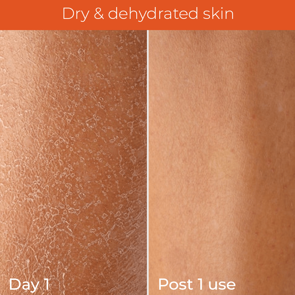 Skinvest smoothie in shower body conditioner body care