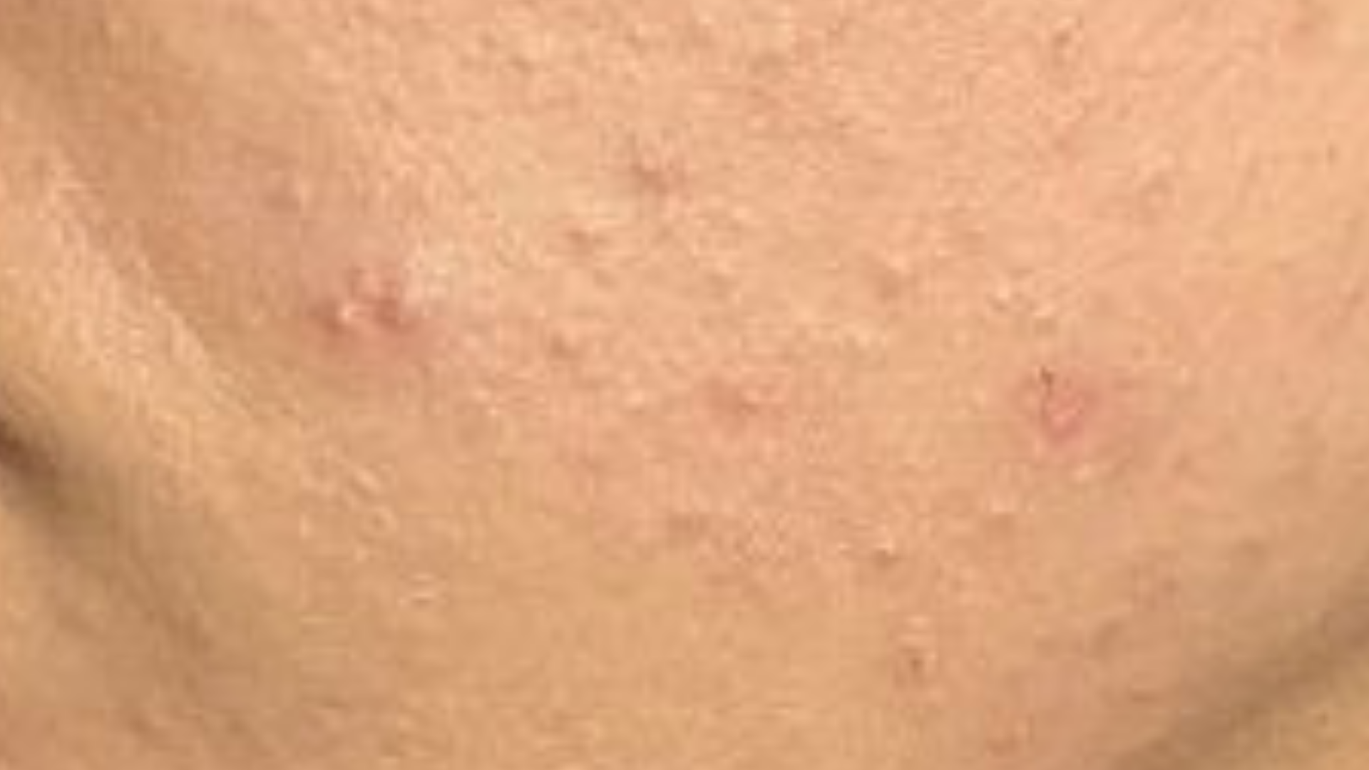 Close-up of skin with visible pores and slight redness