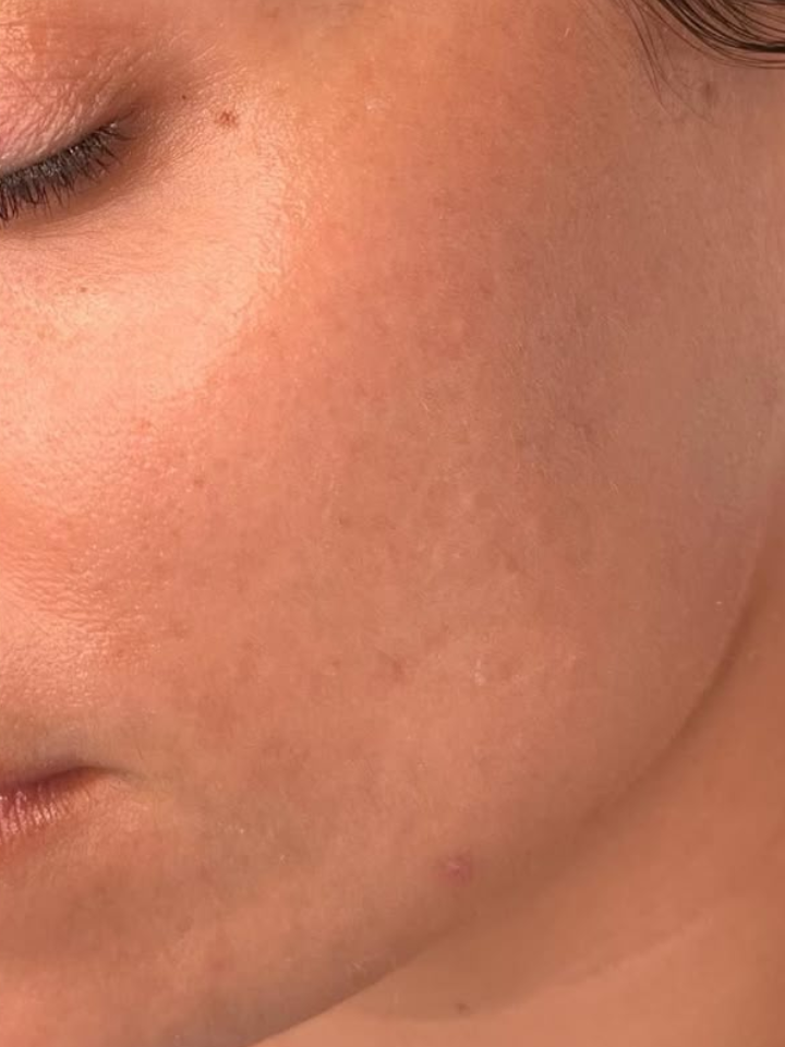 Close-up of a person's face with visible skin texture and pores.