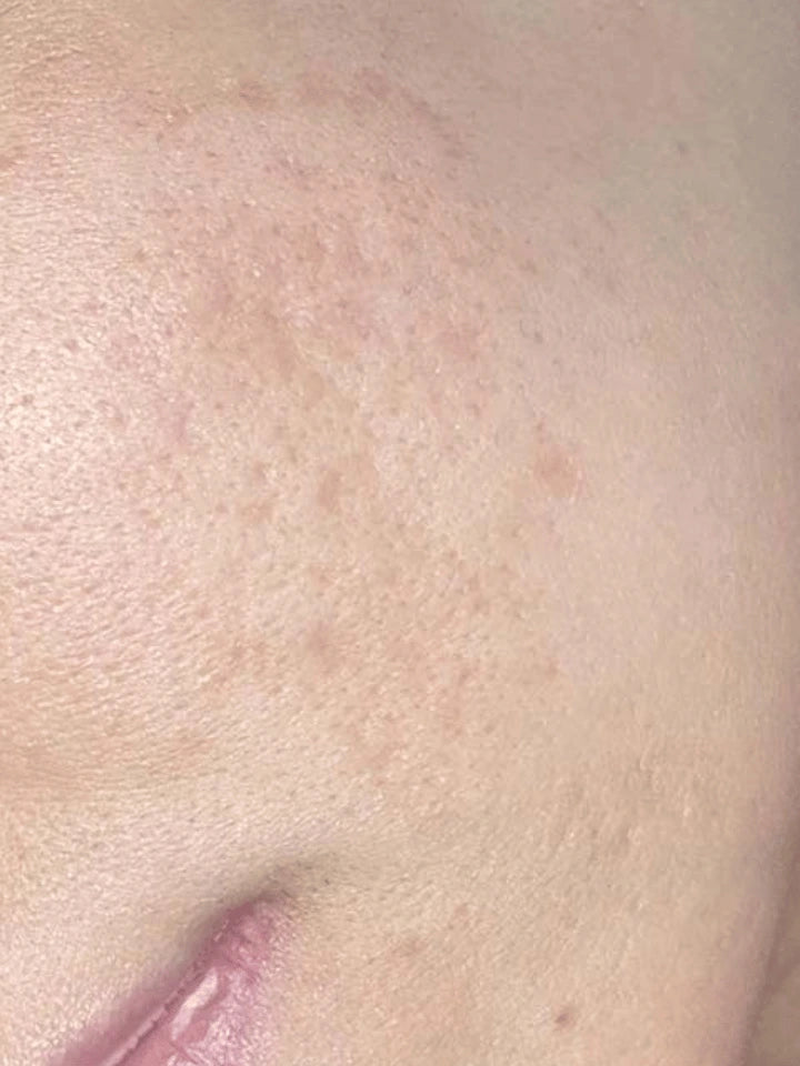 Close-up of a person's neck with visible skin texture and color.
