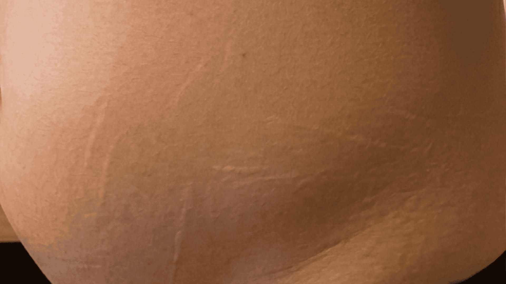 Exfoliating body mist for ingrown hair and razor bumps treatment