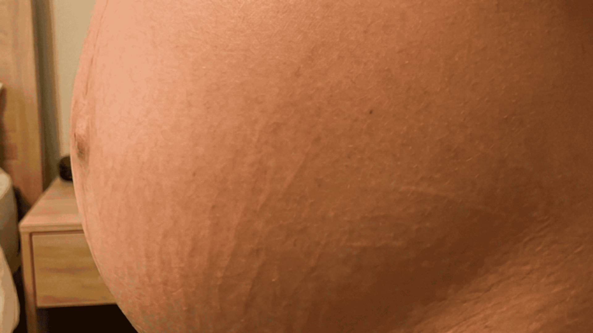Keratosis pilaris exfoliating spray for smooth and clear skin