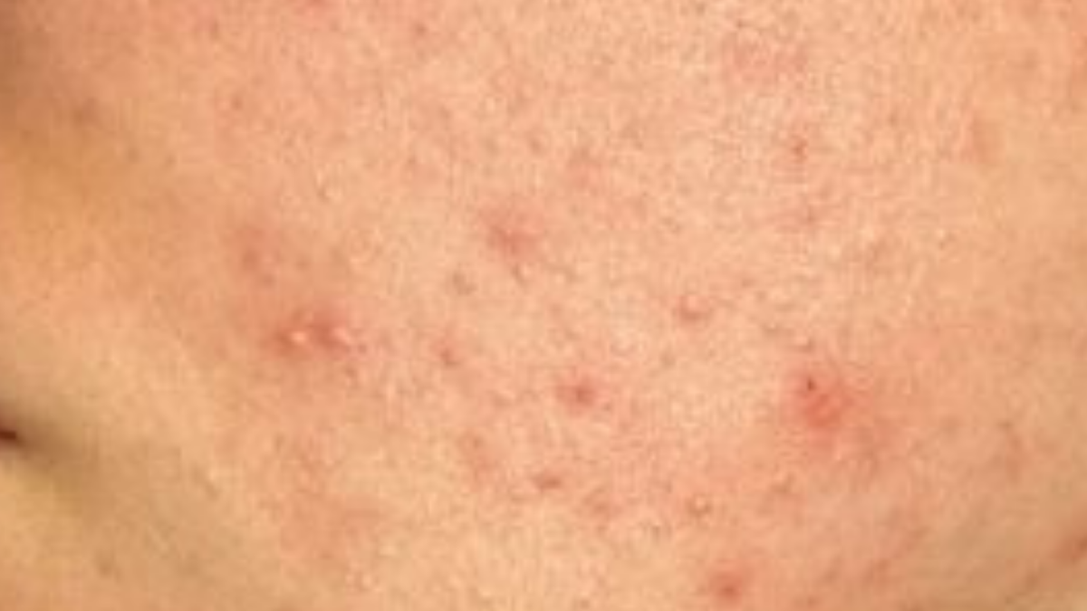 Close-up of skin with visible pores and texture