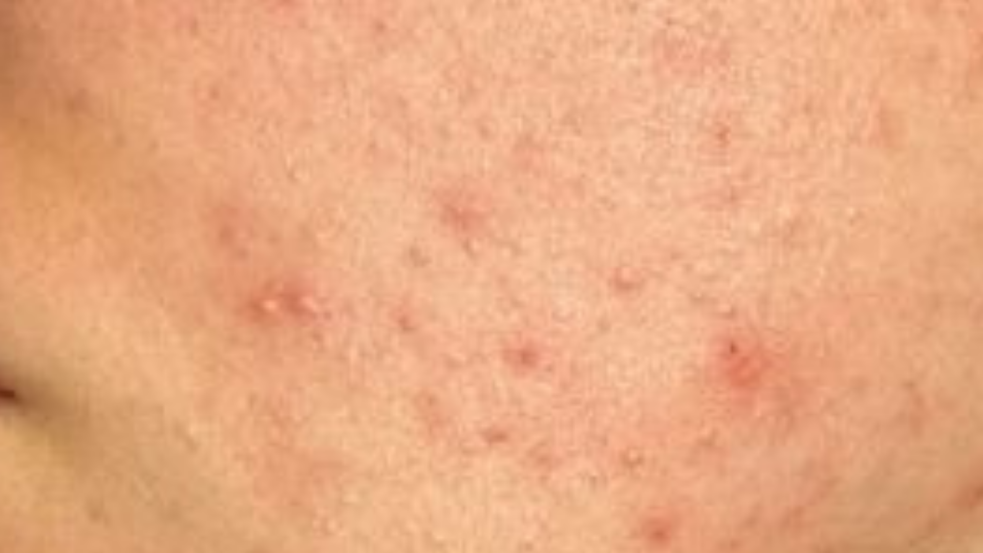 Close-up of skin with visible pores and texture