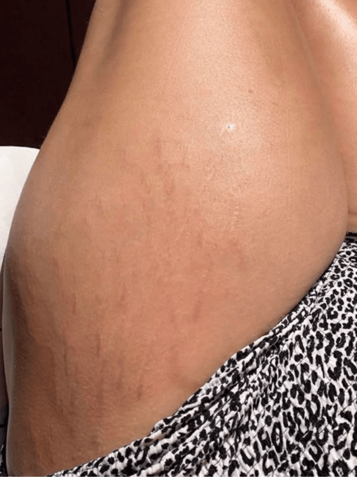 Firming body cream for smoother and toned skin